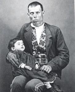 Post mortem